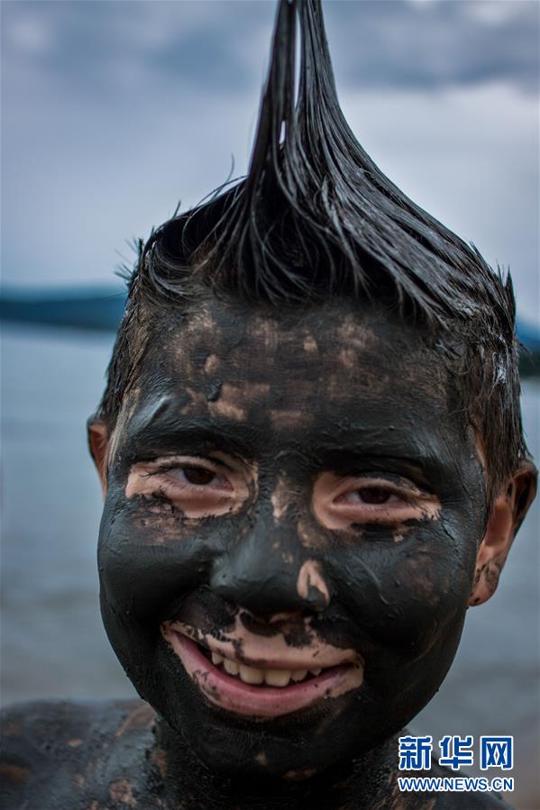\